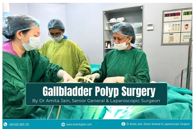 Dr Amita Jain Gallbladder Polyp Surgeon in Delhi Dr Amita Jain Gallbladder Polyp Surgeon in Delhi